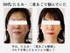 ランティル(l’until)の写真
