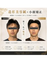 エモシオン トウキョウ(EMOTION TOKYO)/造形美容鍼×小顔矯正