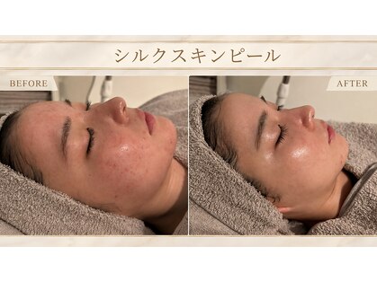 カエラ(KAELA)の写真