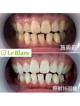 ルブラン 奈良店(Le Blanc)/回数券でも通い放題でも!