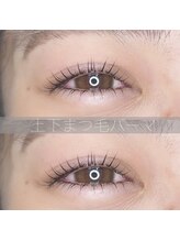 シュシュ ドット アイラッシュ 北千住店(chouchou.eyelash)/上下まつ毛パーマ