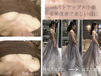 ローズボディ 恵比寿店/脇肉撃退ー小顔バストアップ整体