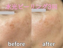ミレット(Miretto)