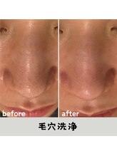 ルアナ 北谷店/毛穴洗浄毛穴ケア 《沖縄/北谷》