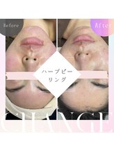 ビューティサロン ベルティア(Beltia)/#ダイエット#痩身#ブライダル