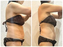 ウェリナ平和堂長久手院/小顔矯正/骨盤矯正/痩身/整体