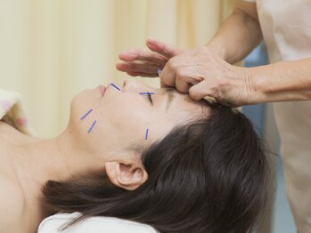 鍼灸院 萌の写真/【美容鍼でリフトアップ】小じわやシミ、肌トラブルをケアして、自信の持てるスッキリ小顔へ導きます♪