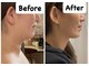 ナユラスパ(Nayula Spa)の写真/今話題の天然オーガニックのレモンボトル(脂肪分解)を使用したフェイシャルが受けられるサロン◎