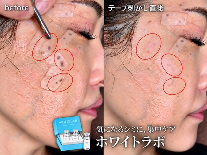 エーアール(ar)の写真