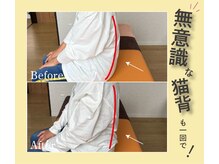 ねね整骨院 エヌシャープ(N#)/無意識な猫背・巻き肩に！