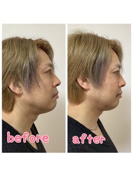 小顔整体 優/首肩周りも整う☆