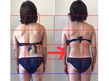 ビューティー サロン ハナ(Beauty Salon hana)の雰囲気（1回の施術効果☆傾いた身体がまっすぐに整いましたね^ ^）