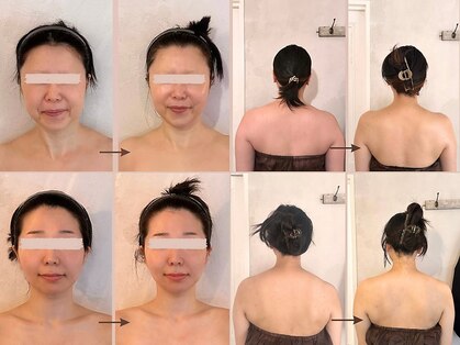 アメアラレ(amearare)の写真