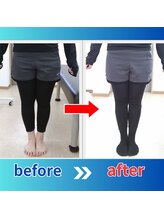 ストレッチヒーロー 倉吉店(STRETCH HERO)/O脚、X脚