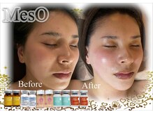 サロンフィーユ(Fille)/あなたは「どのアンプル」？