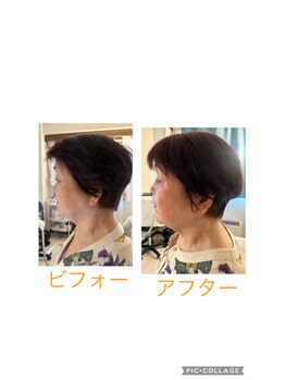 エリシオン(ELYSION)/毛穴たるみ集中改善フェイシャル