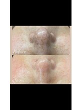 コンディションスキン(condition skin)/