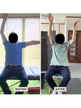 リポスト(RE:POST)/施術効果