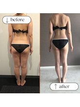 トータルビューティーサロンリア(Li'a)/ビフォー＆アフター