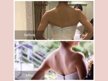 ローズボディ 恵比寿店/天使の羽ー肩甲骨剥がし