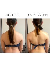 ワン ストレッチ(ONE stretch)/【背中美人】