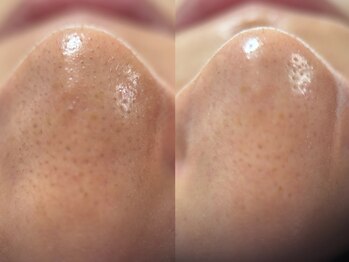 フェリス(FELIZ)/韓国式3D毛穴洗浄+シルク洗顔