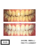 レオン 磐田(REON)/◇ お客様 before＆after ◇