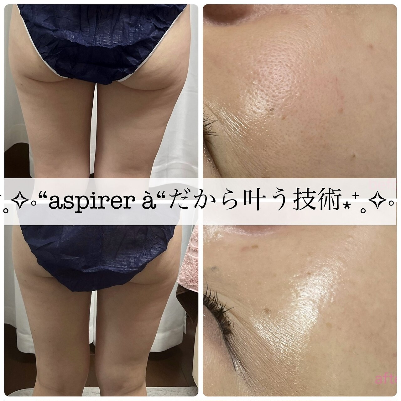 野里駅でフェイシャルエステが人気のエステサロン｜ホットペッパー