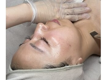 ダーマスキンラボ(DERMA SKIN LAB)の写真/《圧倒的な効果を実感》ララピールが受けられるサロン◇初めての肌管理にもおすすめララピール管理♪