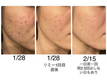 ラ ルミエール(La Lumiere)/ホームケアを入れると速度UP