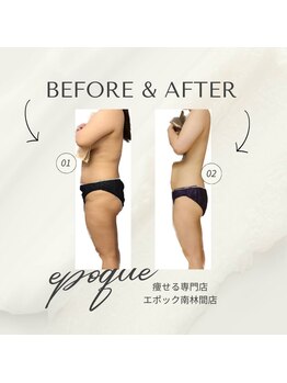 エステティックサロン エポック(epoque)/TMキューブ★スリムボディへ