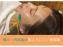 シーワイビー(C.Y.B)/痛み・内出血の出にくい美容鍼