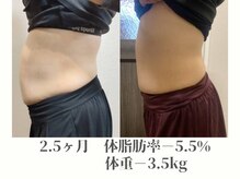 全身脱毛専門店 tenの雰囲気（最先端痩身Fit Carvingでポッコリお腹も改善!運動が苦手な方にも）