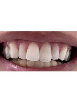 ライトビューティー 本八幡店(LIGHT BEAUTY)/