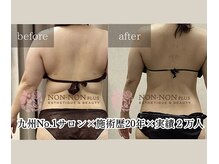 ノンノンプラス 博多(NON-NONプラス)