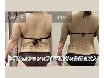 ノンノンプラス 博多(NON-NONプラス)