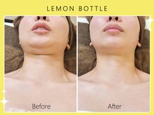 シロカネ イオンタウン西熊本店(SHIROKANE)/レモンボトル☆