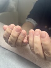 ネイルケア×ドイツ式フットケア専門Ruban 新宿御苑《ハンドケア/深爪/巻き爪》/
