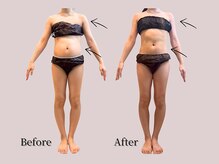 ヨサパーク デイジー(YOSA PARK Daisy)/痩身/ダイエット/リンパ/毛穴