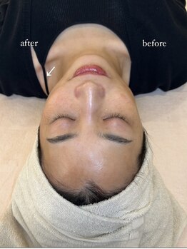 モモ(momo)/こんなにも変わってしまう！？