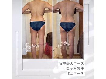レムロード 川口店/背中、腰、ヒップ太ももスッキリ