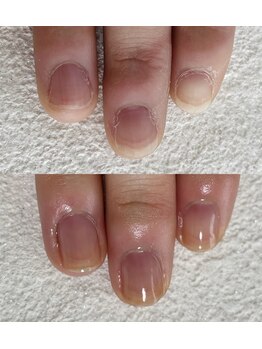 爪の周りもツルツルになります