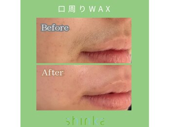 シンカ 湘南江ノ島 鵠沼(shinka)/【部分WAX】オプションメニュー