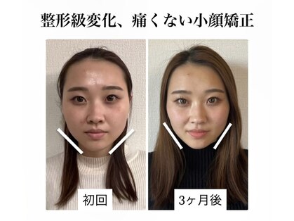 ラボーテヴェリテ(La Beaute Verite)の写真