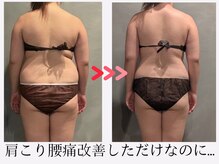 ツーアップ(2up)