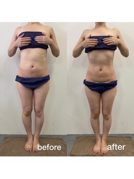 ココ アンジュ(COCO ANGE)/