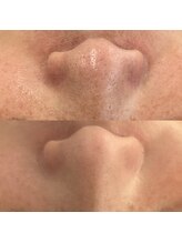 ヴェルシック(Belchic)/毛穴のお悩みお任せください