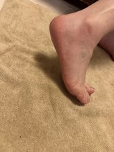 モンチ(monchi)/フット角質ケア