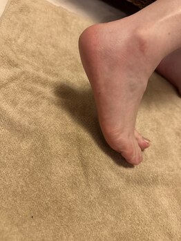 モンチ(monchi)/フット角質ケア