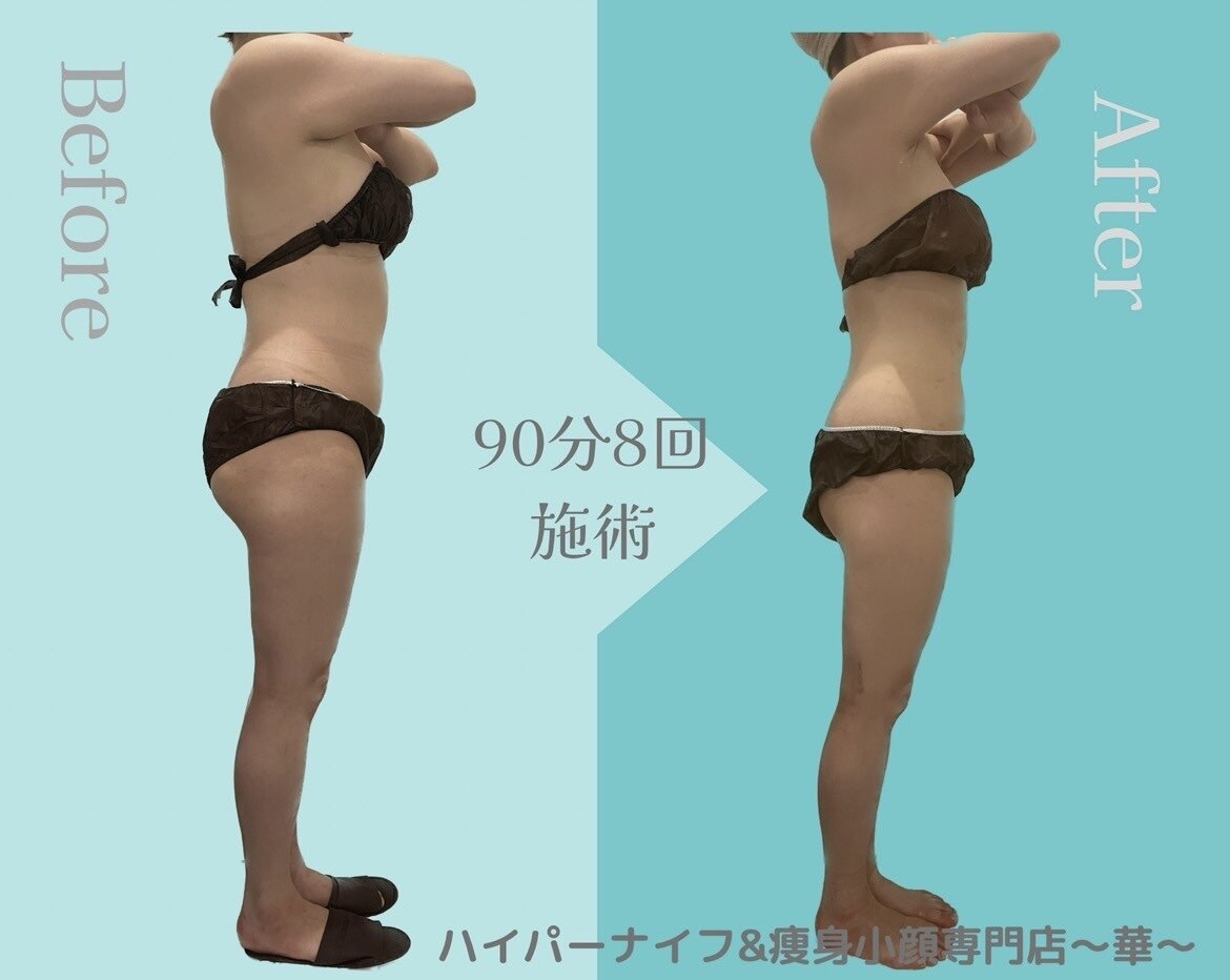 華(hana)｜ホットペッパービューティー